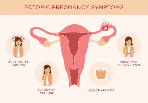 best doctor for ectopic pregnancy in Delhi